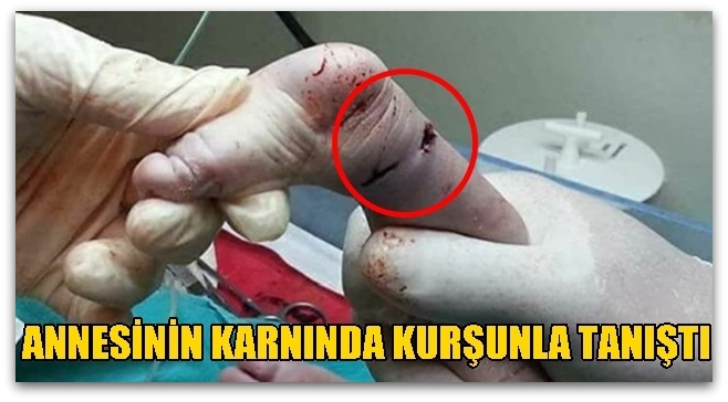 Annesinin Karnında Kurşunla Tanıştı