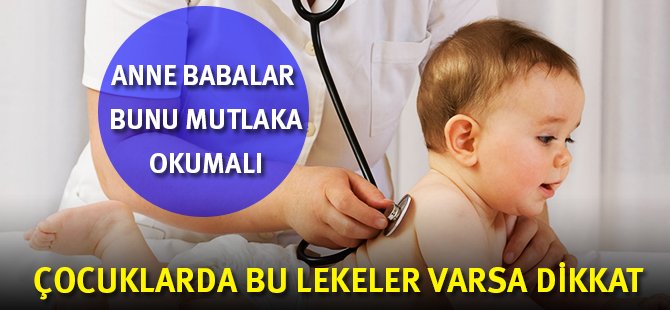 Çocuklarda deri lekelerine dikkat!