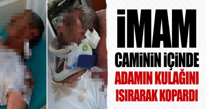 İmam Cemaatin 'kulağımı ısırarak koparttı'