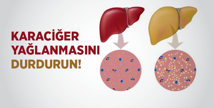 Karaciğer Yağlanmasını Durdurun